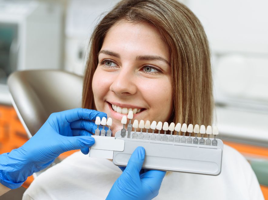 Teeth Whitening shades Ask a dentist about teeth whitening in Melbourne