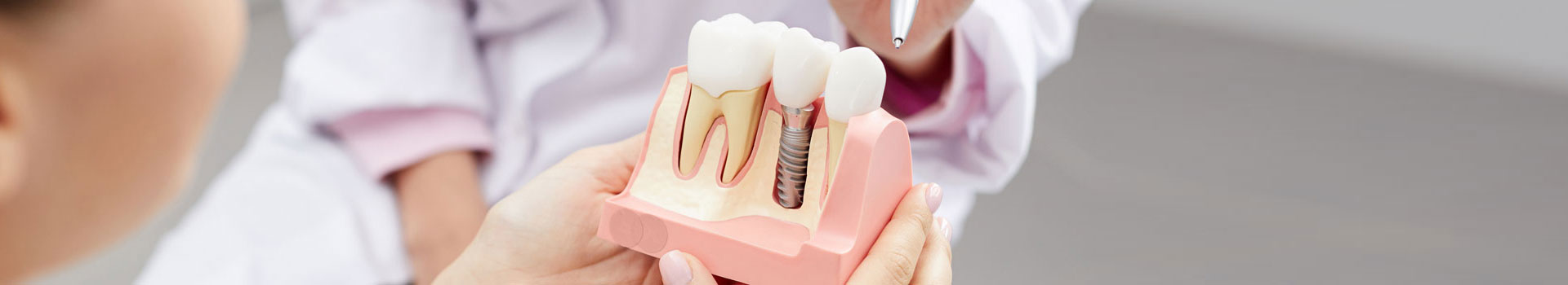 Dental implants in Melbourne Dental implants in Melbourne