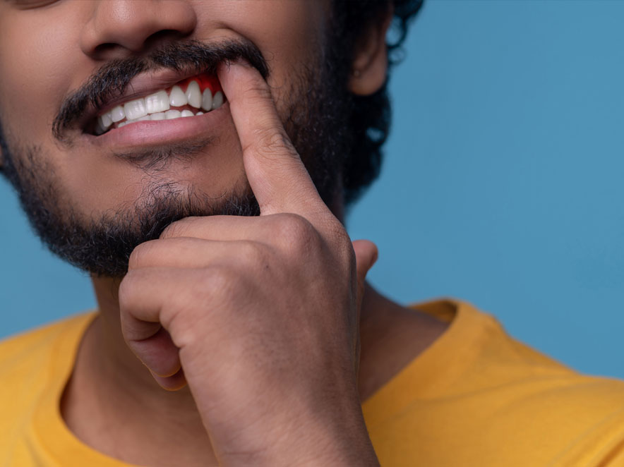 Sore wisdom tooth in Melbourne Sore wisdom tooth in Melbourne