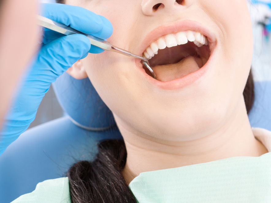 Wisdom teeth removal in Melbourne Wisdom teeth removal in Melbourne