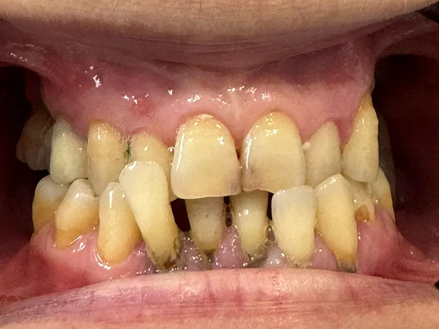 Reclaiming your smile: One step at a time