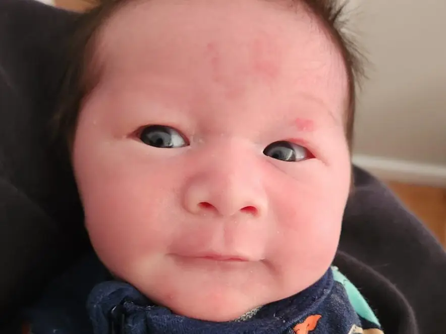 Baby surprise at MC Dental Docklands