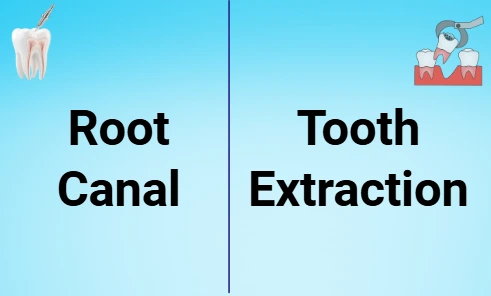 root canal vs. tooth extraction