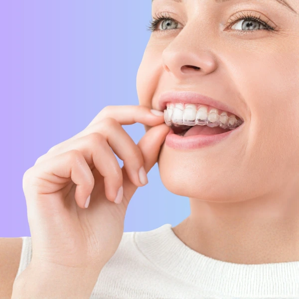 Invisalign timing-mobile