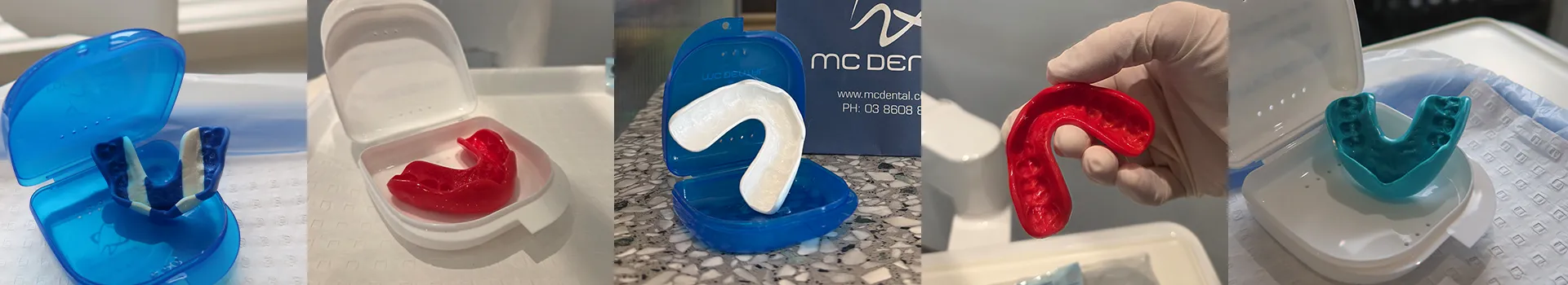 Mouthguard Fitting – expression of interest