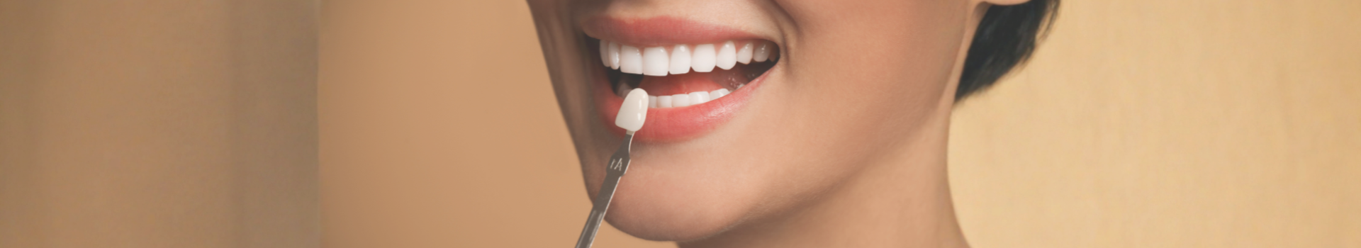dental veneers Brighton