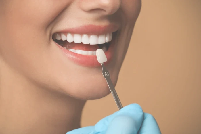 What can Veneers do