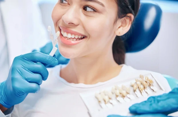 what are Veneers