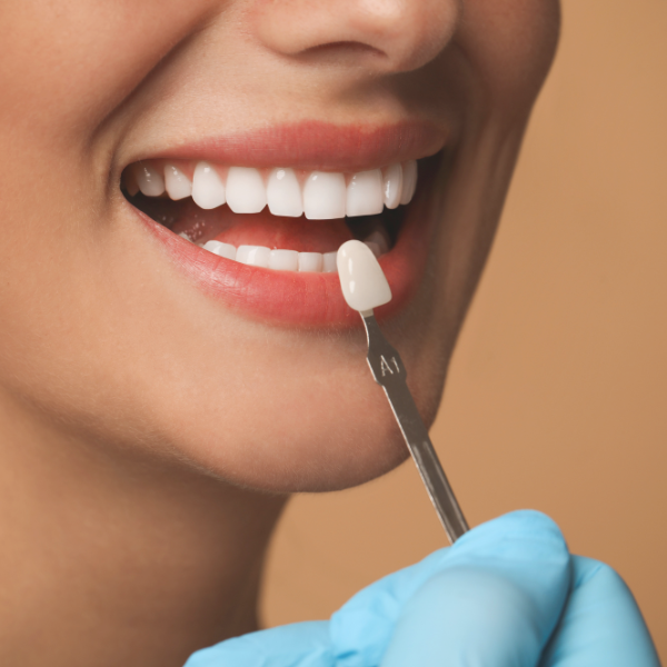 Brighton Veneers