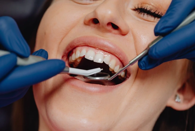 How Is a Gummy Smile Treated