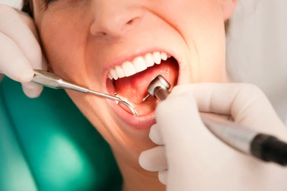 How often should I book a dental check up and clean