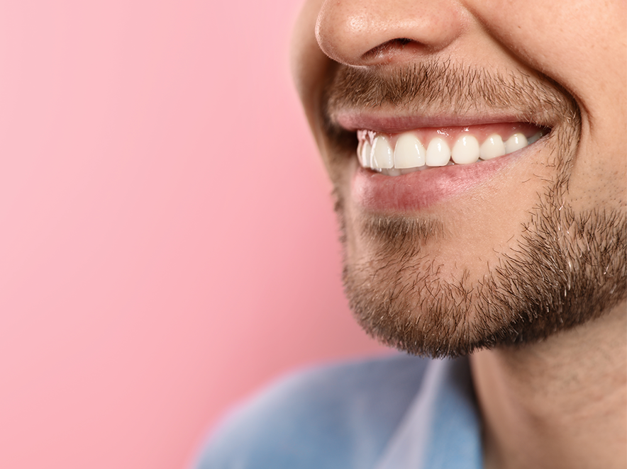 Considerations before teeth whitening