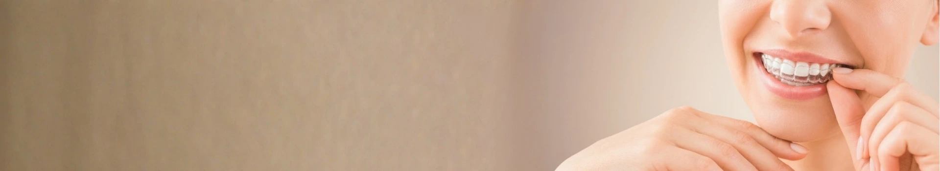invisible aligners