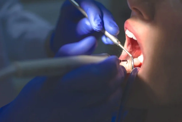 teeth deep clean vs scaling teeth